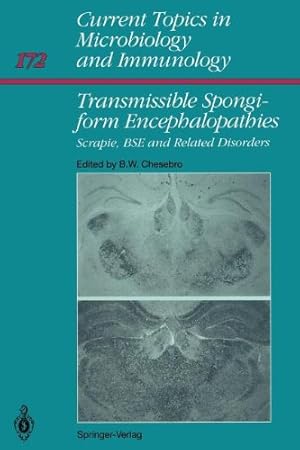 Seller image for Transmissible Spongiform Encephalopathies:: Scrapie, BSE and Related Human Disorders (Current Topics in Microbiology and Immunology) [Paperback ] for sale by booksXpress