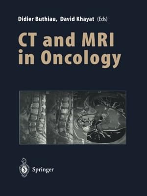 Image du vendeur pour CT and MRI in Oncology [Paperback ] mis en vente par booksXpress