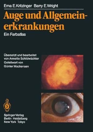 Image du vendeur pour Auge und Allgemeinerkrankungen: Ein Farbatlas (German Edition) by Kritzinger, Erna E., Wright, Barry E. [Paperback ] mis en vente par booksXpress