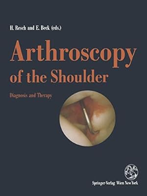 Seller image for Arthroscopy of the Shoulder: Diagnosis and Therapy [Paperback ] for sale by booksXpress