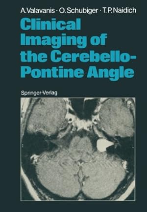 Immagine del venditore per Clinical Imaging of the Cerebello-Pontine Angle by Valavanis, Anton, Schubiger, Othmar, Naidich, Thomas P. [Paperback ] venduto da booksXpress