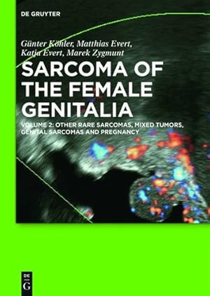 Immagine del venditore per Other Rare Sarcomas, Mixed Tumors, Genital Sarcomas and Pregnancy: Other Rare Sarcomas, Mixed Tumors, Genital Sarcomas and Pregnancy by Kohler, Gunter, Evert, Matthias, Evert, Katja, Zygmunt, Marek [Hardcover ] venduto da booksXpress