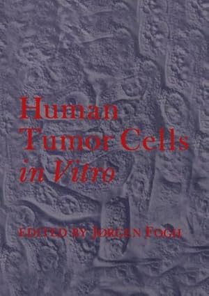 Seller image for Human Tumor Cells in Vitro [Paperback ] for sale by booksXpress