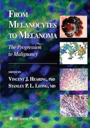 Seller image for From Melanocytes to Melanoma: The Progression to Malignancy [Paperback ] for sale by booksXpress