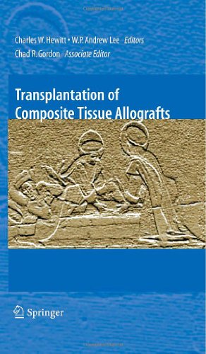Bild des Verkufers fr Transplantation of Composite Tissue Allografts [Hardcover ] zum Verkauf von booksXpress