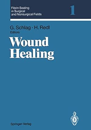 Seller image for Fibrin Sealing in Surgical and Nonsurgical Fields: Volume 1: Wound Healing (v. 1) by Peter Holleczek, G\xfcnther [Paperback ] for sale by booksXpress