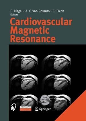 Imagen del vendedor de Cardiovascular Magnetic Resonance [Paperback ] a la venta por booksXpress