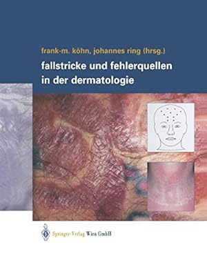 Bild des Verkufers fr Fallstricke und Fehlerquellen in der Dermatologie (German Edition) [Paperback ] zum Verkauf von booksXpress