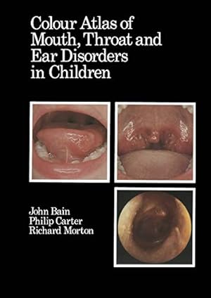 Seller image for Colour Atlas of Mouth, Throat and Ear Disorders in Children [Soft Cover ] for sale by booksXpress