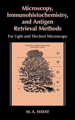 Immagine del venditore per Microscopy, Immunohistochemistry, and Antigen Retrieval Methods: For Light and Electron Microscopy by Hayat, M.A. [Paperback ] venduto da booksXpress