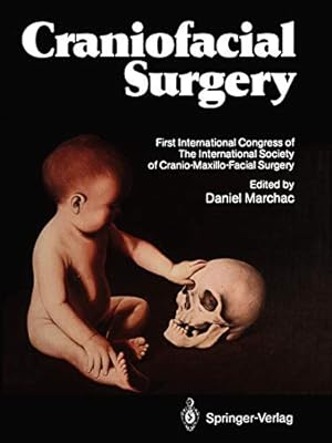 Bild des Verkufers fr Craniofacial Surgery: Proceedings of the First International Congress of The International Society of Cranio-Maxillo-Facial Surgery. President: Paul Tessier. Cannes-La Napoule, 1985 [Soft Cover ] zum Verkauf von booksXpress