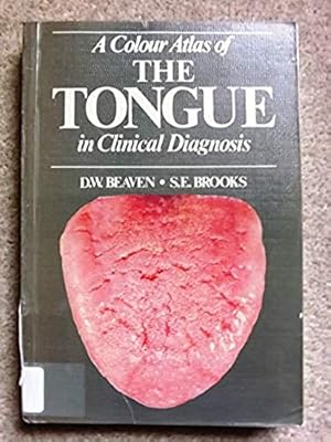 A Colour Atlas of the Tongue in Clinical Diagnosis