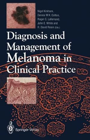 Bild des Verkufers fr Diagnosis and Management of Melanoma in Clinical Practice [Paperback ] zum Verkauf von booksXpress