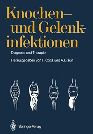Immagine del venditore per Knochen- und Gelenkinfektionen: Diagnose und Therapie 5. Heidelberger Orthopädie-Symposium (German Edition) [Soft Cover ] venduto da booksXpress