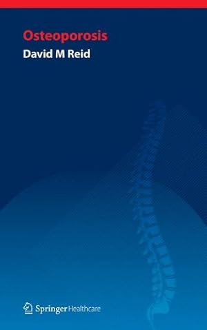Imagen del vendedor de Handbook of Osteoporosis by Reid, David [Paperback ] a la venta por booksXpress