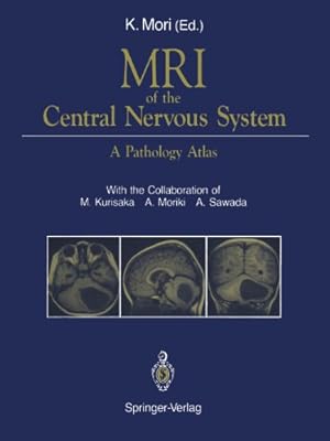 Seller image for MRI of the Central Nervous System: A Pathology Atlas [Paperback ] for sale by booksXpress