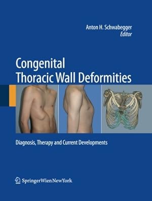 Immagine del venditore per Congenital Thoracic Wall Deformities: Diagnosis, Therapy and Current Developments [Paperback ] venduto da booksXpress