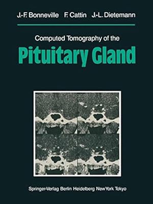 Image du vendeur pour Computed Tomography of the Pituitary Gland: With a Chapter on Magnetic Resonance Imaging of the Sellar and Juxtasellar Region, By M. Mu Huo Teng and K. Sartor by Bonneville, Jean-Francois, Cattin, F., Dietemann, Jean-Louis [Paperback ] mis en vente par booksXpress