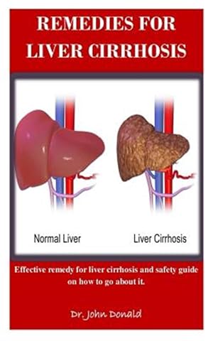 Seller image for Remedies For Liver Cirrhosis: Effective remedies for liver cirrhosis and safety guide on how to go about it for sale by GreatBookPrices