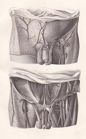 Bild des Verkufers fr Anatomische Tafel. Unterbauch- und Leistengegend des Mannes zum Verkauf von Antiquariat Kastanienhof