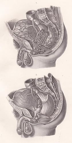 Bild des Verkufers fr Anatomische Tafel. Anatomie des mnnlichen Beckens in seitlicher Ansicht zum Verkauf von Antiquariat Kastanienhof