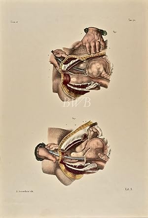Immagine del venditore per Malattie dell'utero [Diseases of the uterus] venduto da Blue Whale Books, ABAA