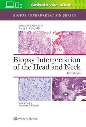 Imagen del vendedor de Biopsy Interpretation of the Head and Neck a la venta por GreatBookPrices