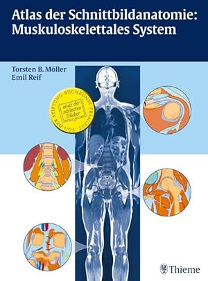 Imagen del vendedor de Atlas der Schnittbildanatomie: Muskuloskelettales System a la venta por moluna