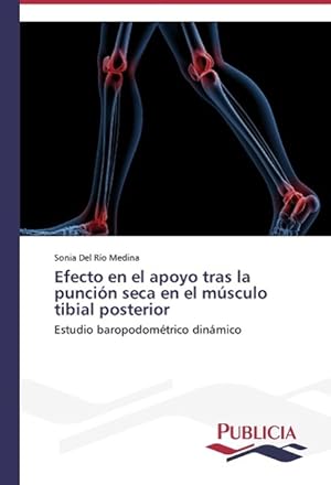 Bild des Verkufers fr Efecto en el apoyo tras la puncin seca en el msculo tibial posterior zum Verkauf von moluna