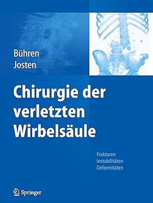Seller image for Chirurgie der verletzten Wirbelsaeule for sale by moluna