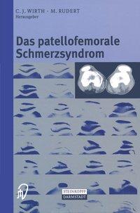 Seller image for Das patellofemorale Schmerzsyndrom for sale by moluna