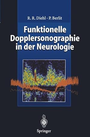 Bild des Verkufers fr Funktionelle Dopplersonographie in der Neurologie zum Verkauf von moluna