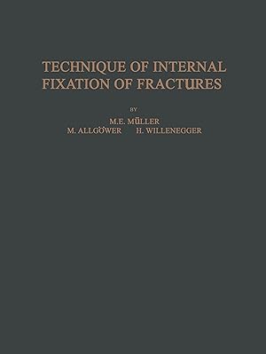 Seller image for Technique of Internal Fixation of Fractures for sale by moluna