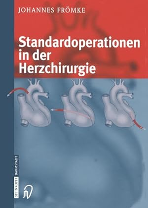 Immagine del venditore per Standardoperationen in der Herzchirurgie venduto da moluna