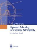 Seller image for Ligament Balancing in Total Knee Arthroplasty for sale by moluna