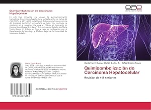Imagen del vendedor de Quimioembolizacin de Carcinoma Hepatocelular a la venta por moluna