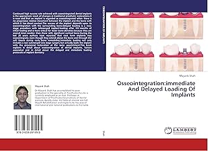 Seller image for Osseointegration:immediate And Delayed Loading Of Implants for sale by moluna