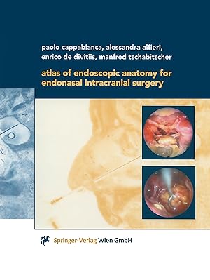 Seller image for Atlas of Endoscopic Anatomy for Endonasal Intracranial Surgery for sale by moluna