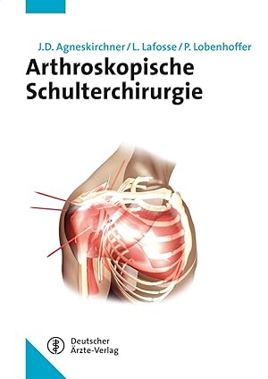 Bild des Verkufers fr Arthroskopische Schulterchirurgie zum Verkauf von moluna