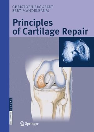 Immagine del venditore per Principles of Cartilage Repair venduto da moluna