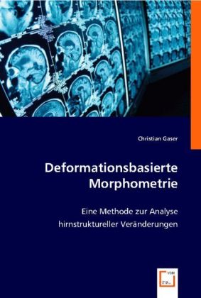 Seller image for Deformationsbasierte Morphometrie for sale by moluna