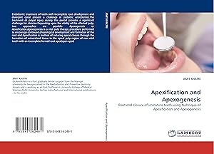 Seller image for Apexification and Apexogenesis for sale by moluna