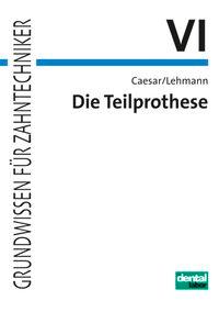 Seller image for Die Teilprothese for sale by moluna