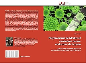 Bild des Verkufers fr Polyomavirus de Merkel et carcinome neuro-endocrine de la peau zum Verkauf von moluna