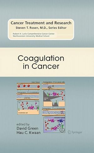 Seller image for Coagulation in Cancer for sale by moluna