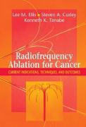 Bild des Verkufers fr Radiofrequency Ablation for Cancer zum Verkauf von moluna