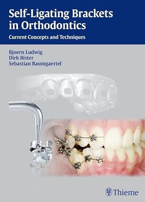 Seller image for Self-ligating Brackets in Orthodontics for sale by moluna