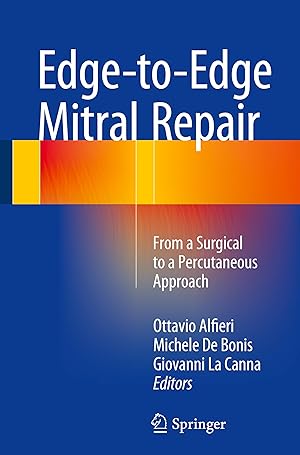 Seller image for Edge-to-Edge Mitral Repair for sale by moluna