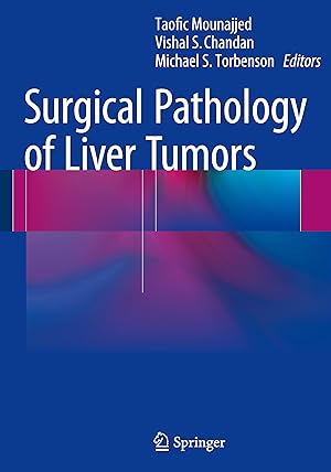 Bild des Verkufers fr Surgical Pathology of Liver Tumors zum Verkauf von moluna