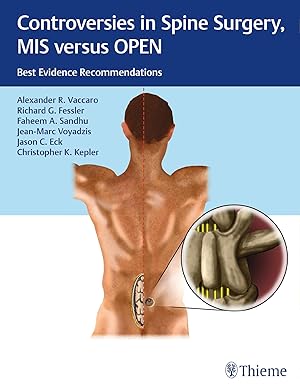 Bild des Verkufers fr Controversies in Spine Surgery: MIS versus OPEN zum Verkauf von moluna